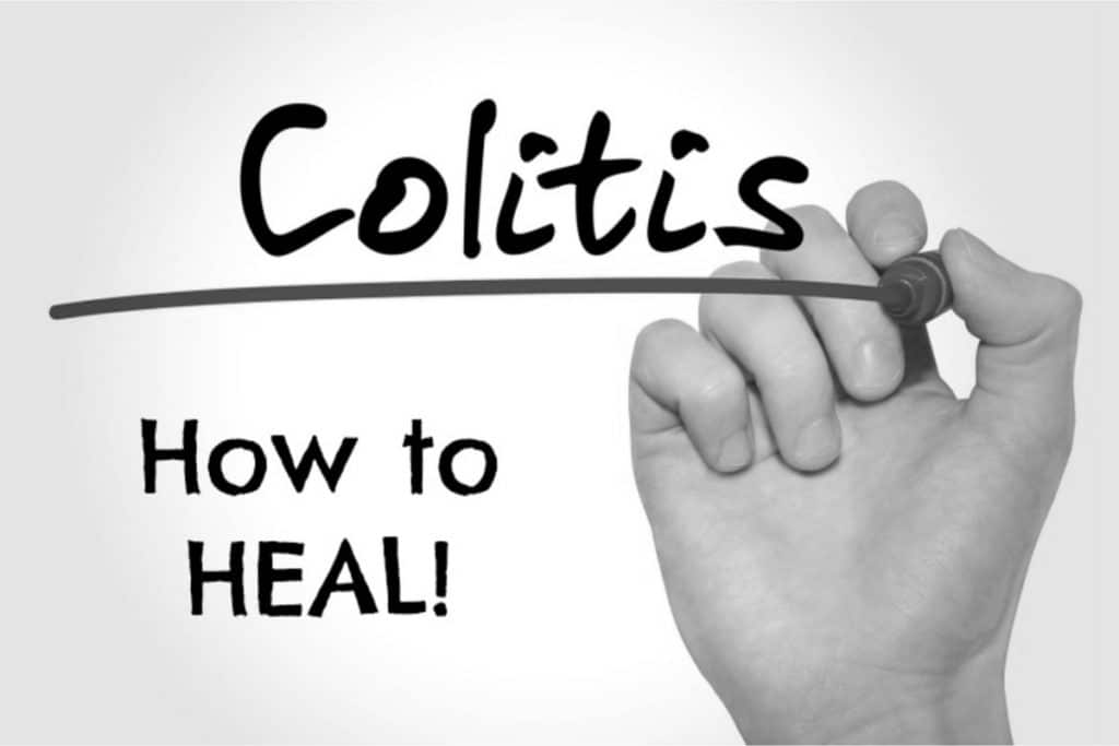 Colitis and Ulcerative Colitis