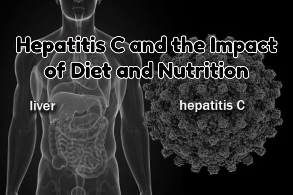 Hepatitis C gastro in Florida