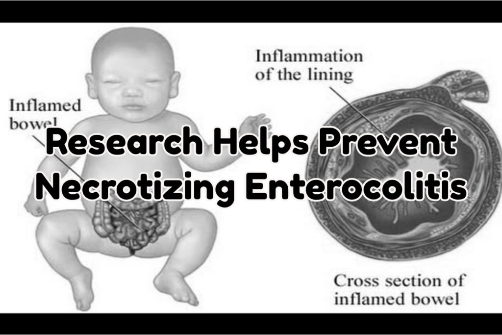 Necrotizing Enterocolitis