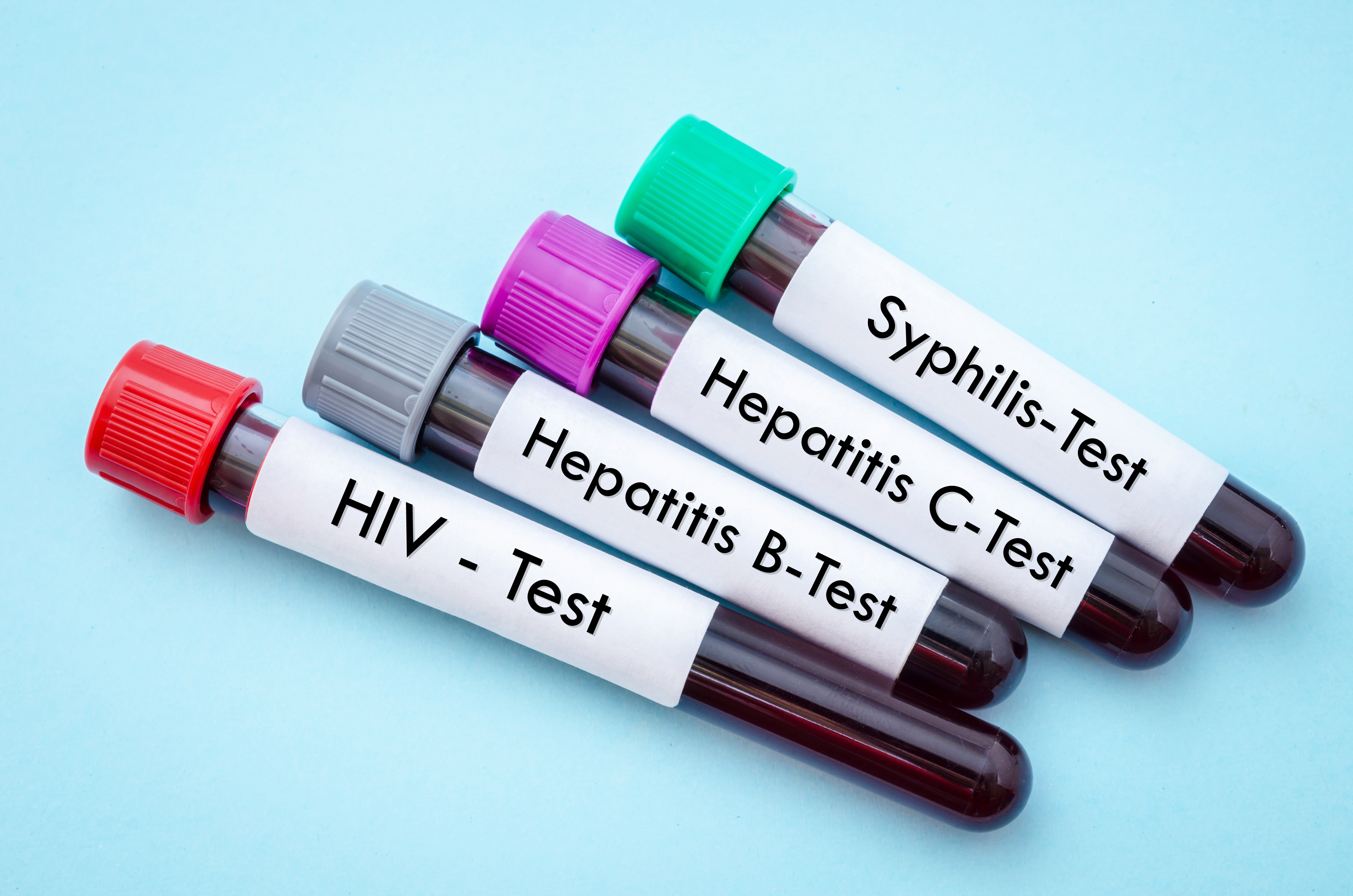 Hepatitis C Tests