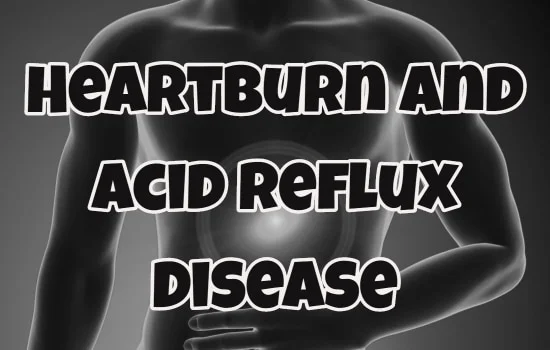 Heartburn and Acid Reflux Disease