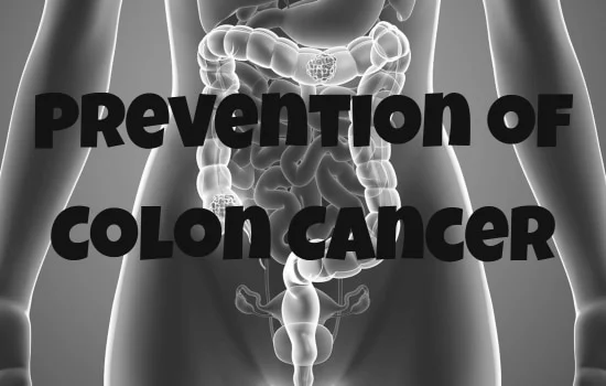 Prevention of Colon Cancer