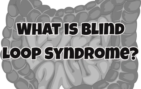 What is Blind Loop Syndrome-