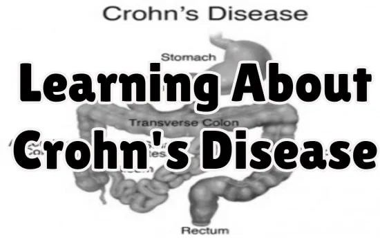 Learning About Crohn's Disease