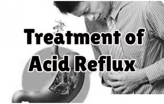 Treatment of Acid Reflux