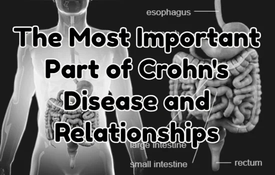 The Most Important Part of Crohn's Disease and Relationships