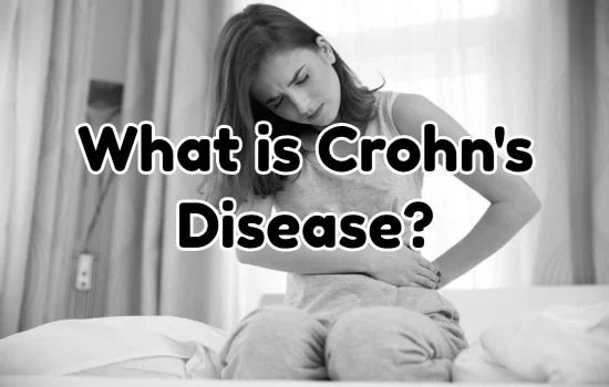 What is Crohn's Disease