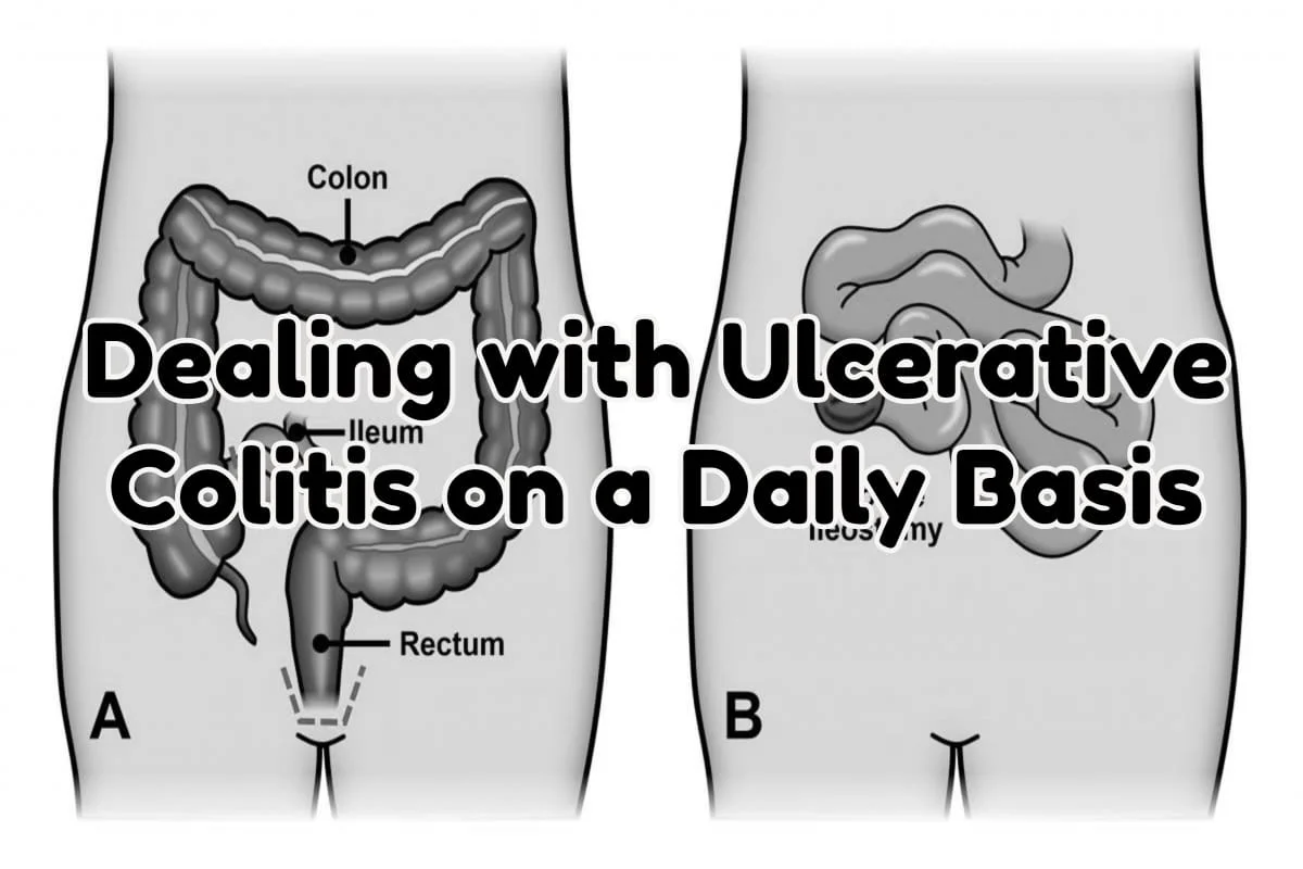 Dealing with Ulcerative Colitis on a Daily Basis