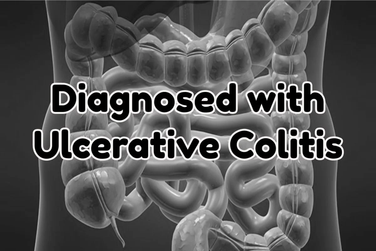 Diagnosed with Ulcerative Colitis