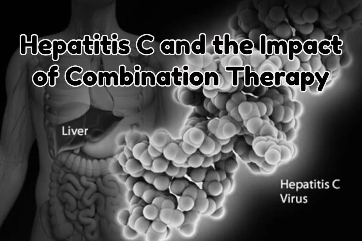 Hepatitis C and the Impact of Combination Therapy