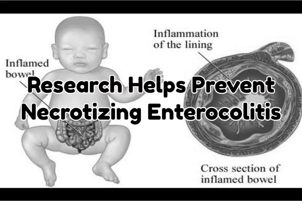 Necrotizing Enterocolitis