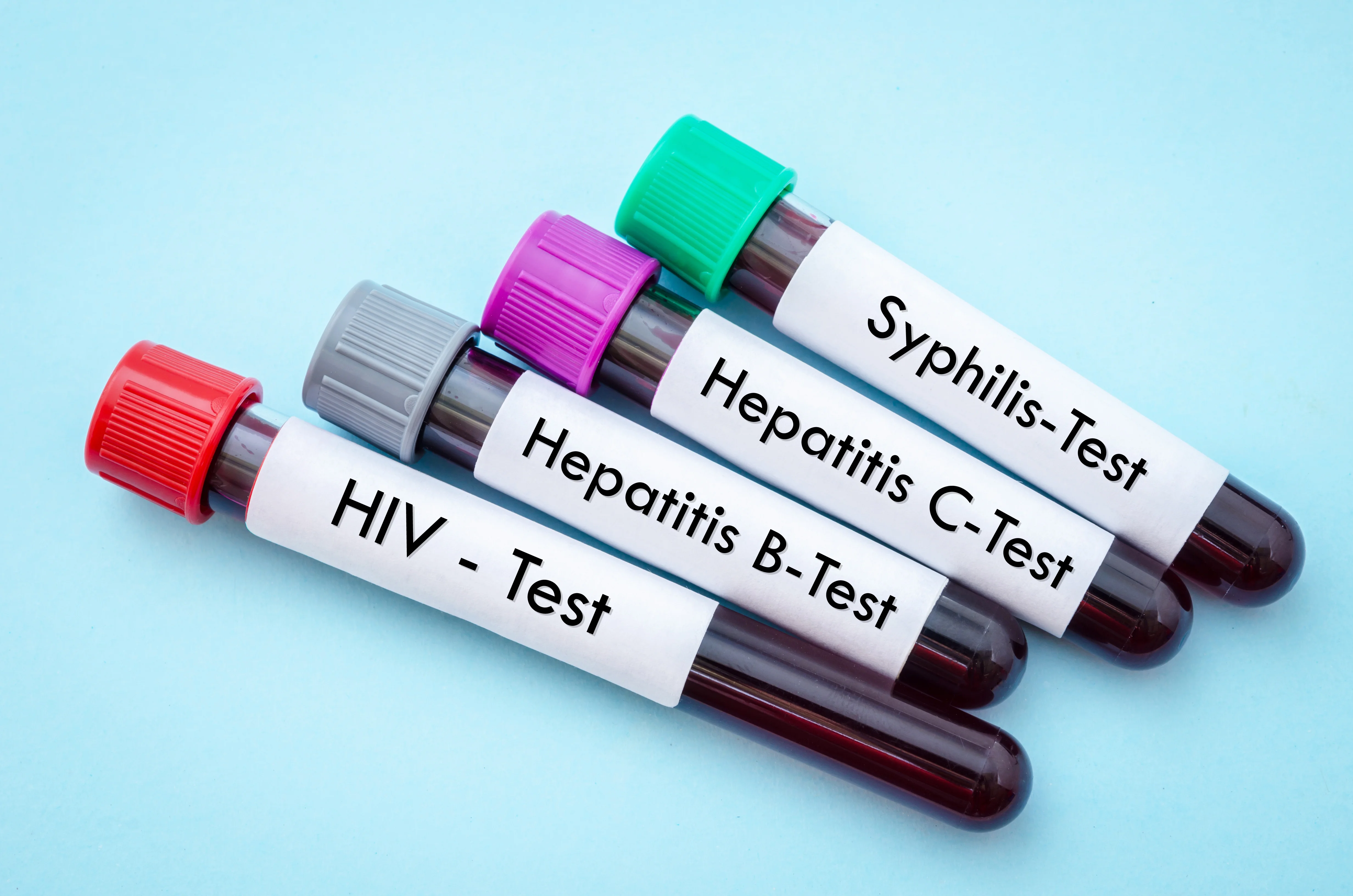 Hepatitis C Tests