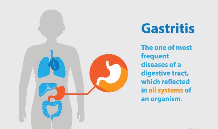 What is Gastritis?